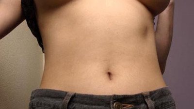 용서한근친